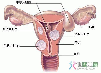 <b>女性不育的子宫因素有哪些</b>